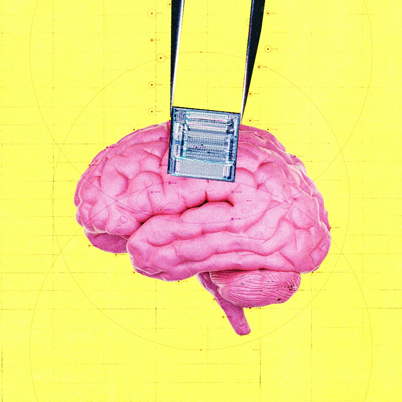 OpenAI Invests in Startup That Uses Brain Implants to Detect Cancer — Wired